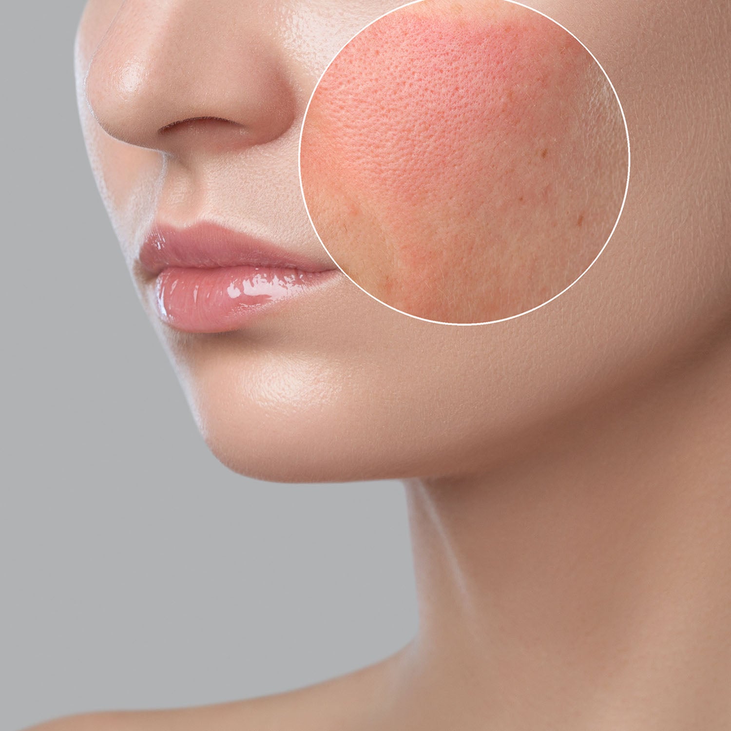 Illustration of redness and irritation on a women's face