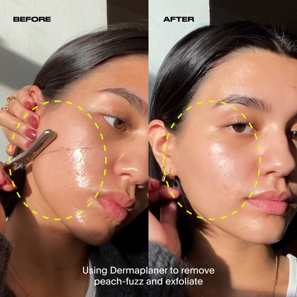 A before and after of the cheek with the dermaplaner